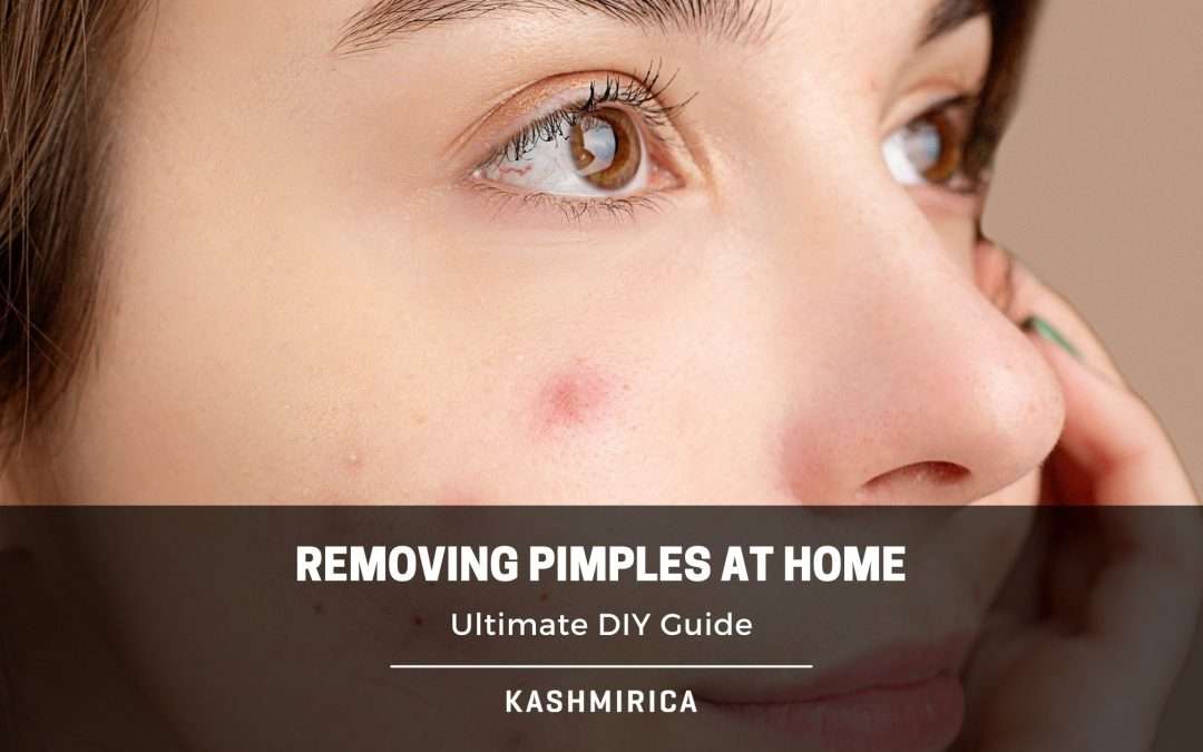 How to Remove Pimples at Home?- 7 Effective Ways